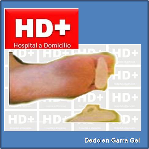 Protector de Dedo en Garra de PIES en Gel